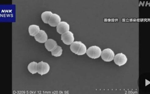 确诊超1100例！日本“食人菌”感染病例持续增加！-日本食人案