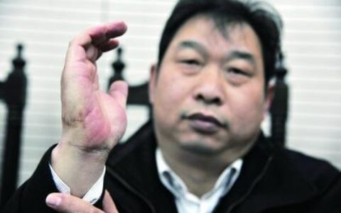 称被酒瓶炸伤 消费者告物美
