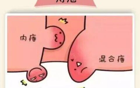 【广州建康医院是正规的】护菊小贴士｜肛肠问题知多少？-广州建康医院简介